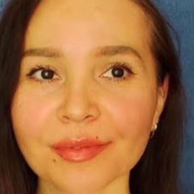 #L190: Aysel: Mặt sưng húp, mũm mĩm, "béo"? | Massage dẫn lưu bạch huyết